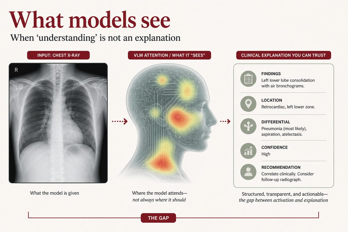 What models see when they say they understand