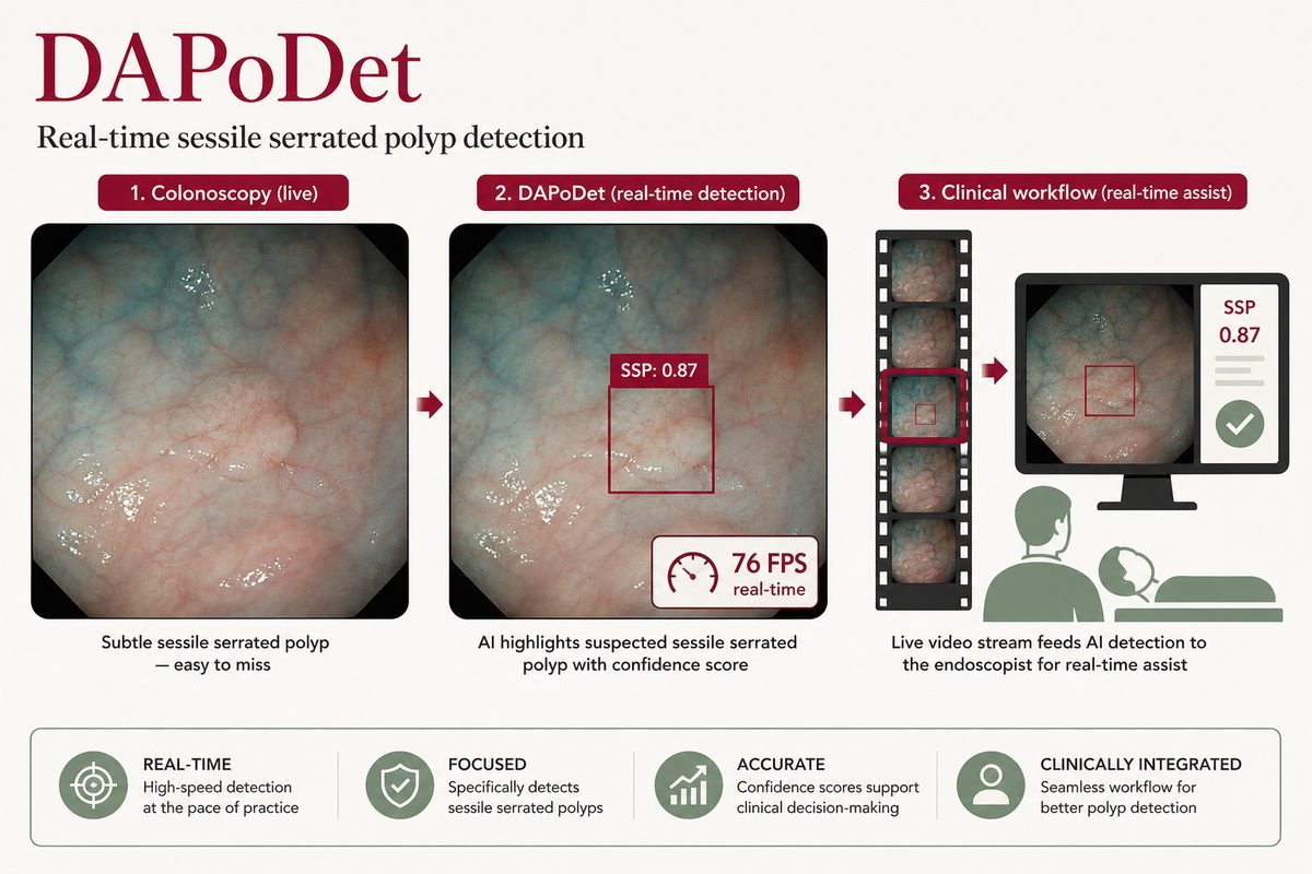 Enhancing Colonoscopy Outcomes with DAPoDet-based AI for Real-time Sessile Serrated Polyp Detection